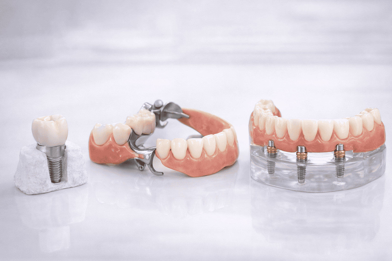 Prótesis Dentales en Sevilla