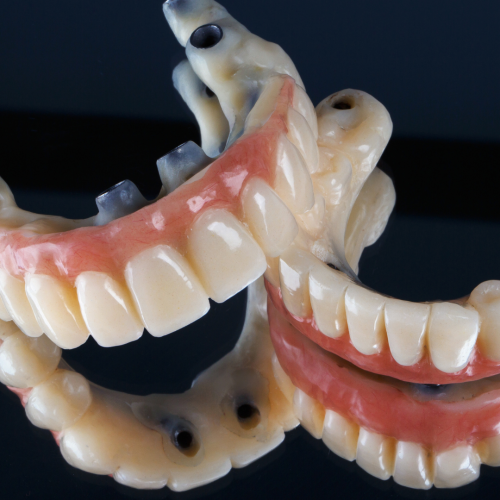 protesis dental sevilla este